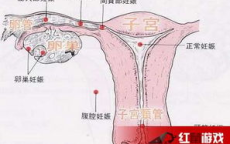 彩礼索求与宫外孕切子宫：离婚背后的彩礼困境